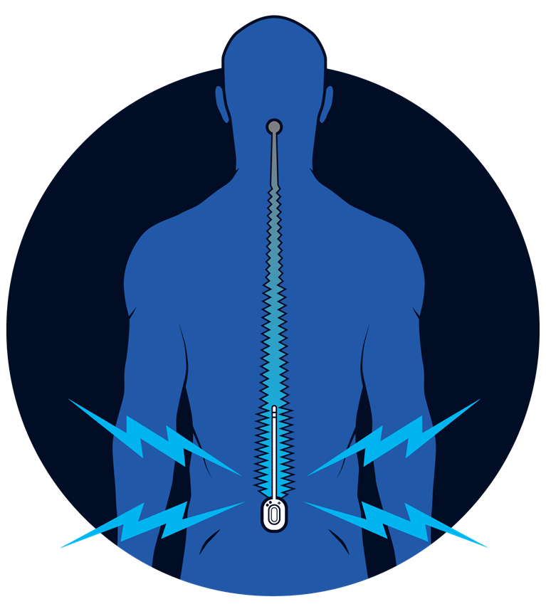 Electroceuticals